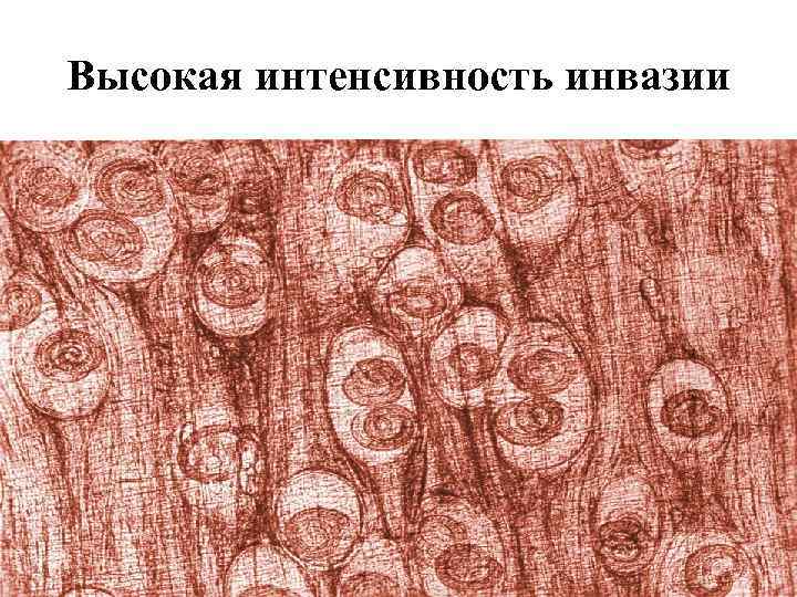 Высокая интенсивность инвазии 