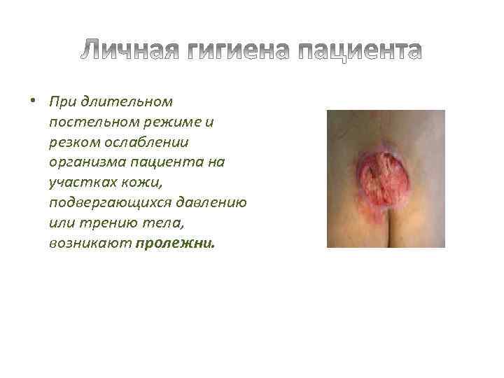  • При длительном постельном режиме и резком ослаблении организма пациента на участках кожи,