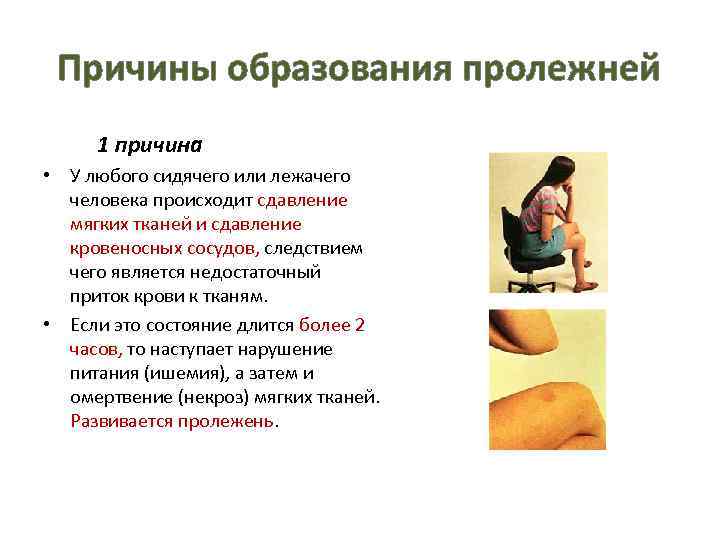 Причины образования пролежней 1 причина • У любого сидячего или лежачего человека происходит сдавление