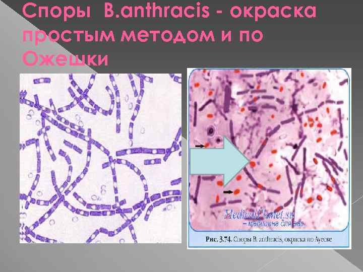 Споры B. anthracis - окраска простым методом и по Ожешки 