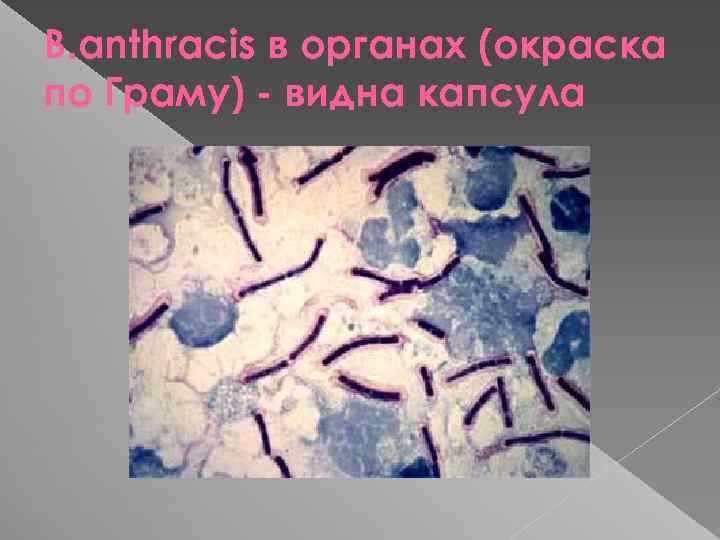 B. аnthracis в органах (окраска по Граму) - видна капсула 