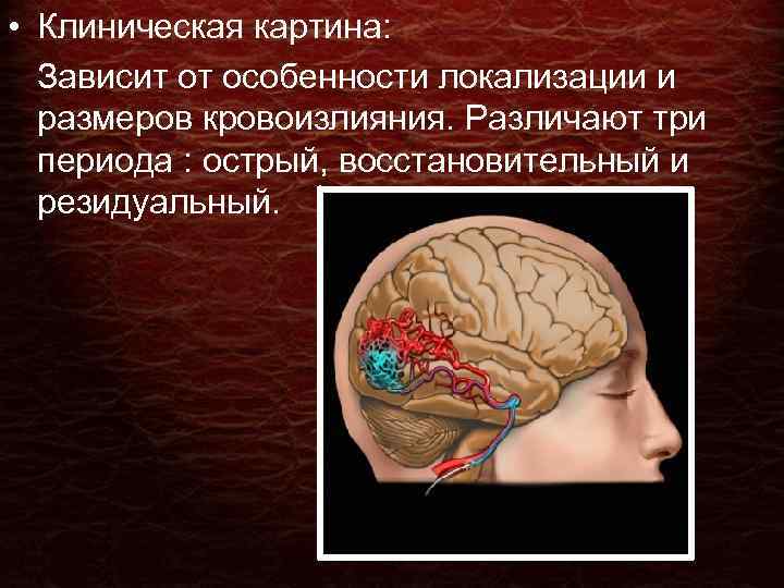  • Клиническая картина: Зависит от особенности локализации и размеров кровоизлияния. Различают три периода