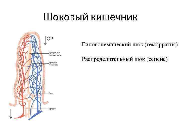 Шоковый кишечник Гиповолемический шок (геморрагия) Распределительный шок (сепсис) 