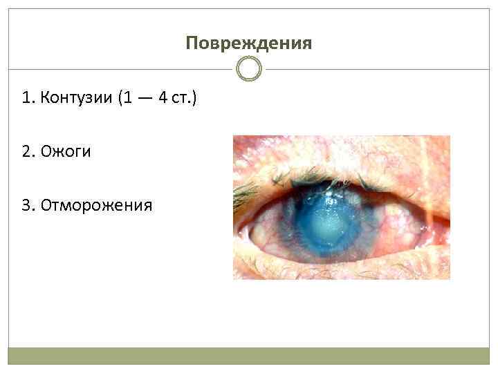 Повреждения 1. Контузии (1 — 4 ст. ) 2. Ожоги 3. Отморожения 