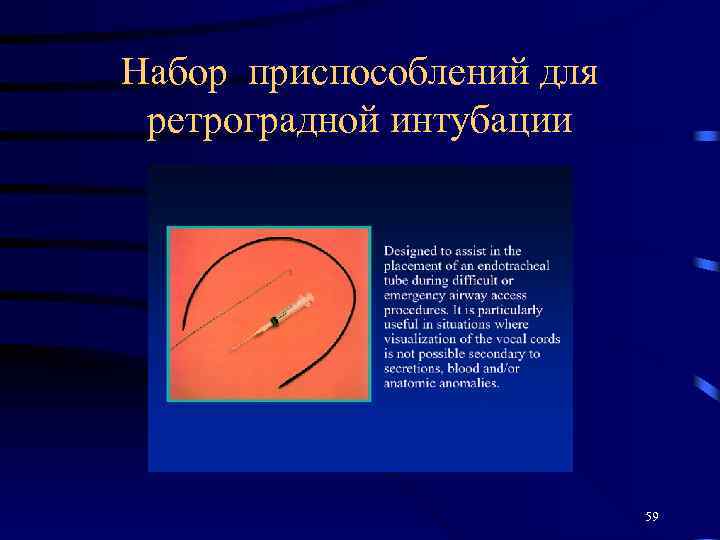 Набор приспособлений для ретроградной интубации 59 