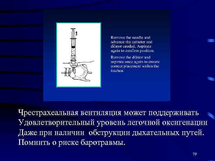 Чрестрахеальная вентиляция может поддерживать Удовлетворительный уровень легочной оксигенации Даже при наличии обструкции дыхательных путей.