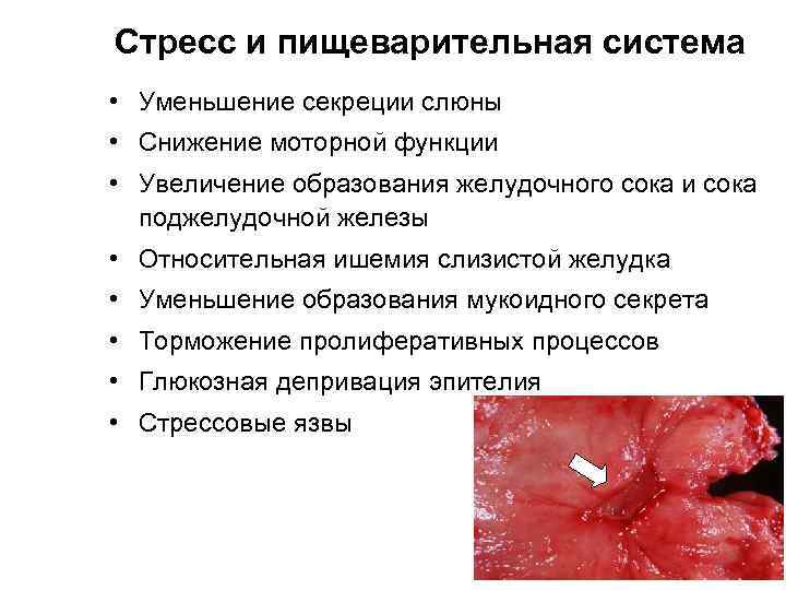 Стресс и пищеварительная система • Уменьшение секреции слюны • Снижение моторной функции • Увеличение