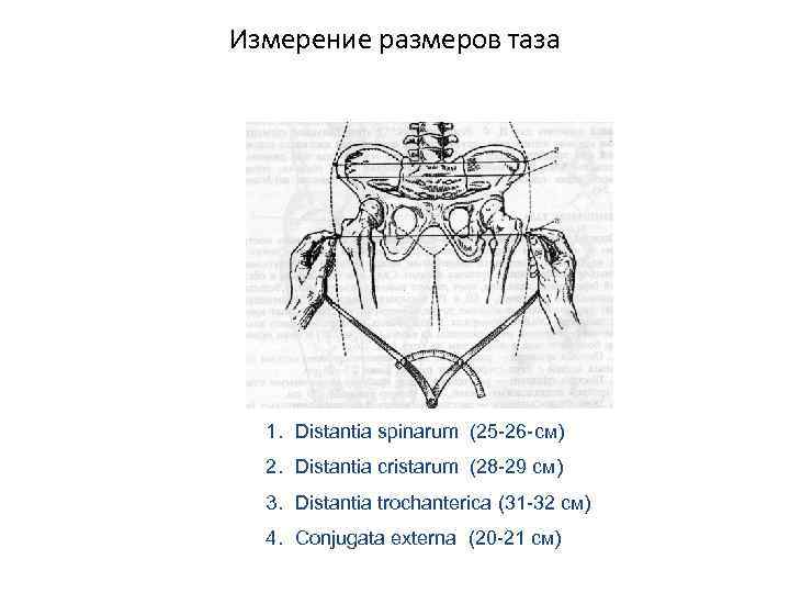 Измерение размеров таза 1. Distantia spinarum (25 -26 -см) 2. Distantia cristarum (28 -29