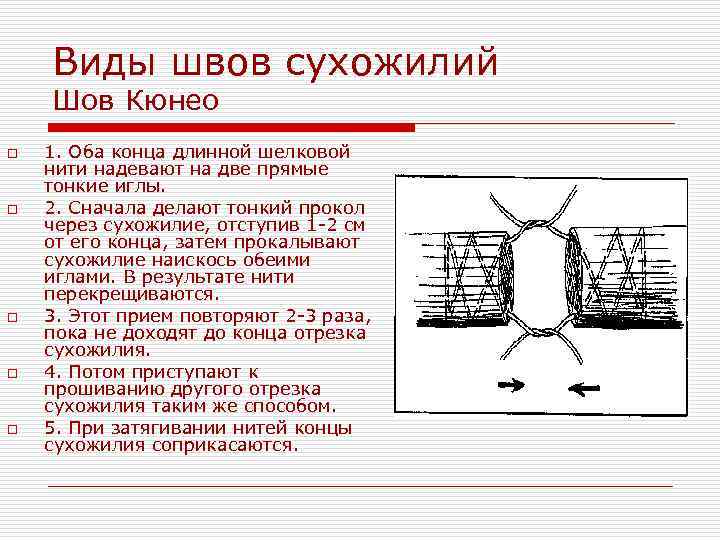 Виды швов сухожилий Шов Кюнео o o o 1. Оба конца длинной шелковой нити