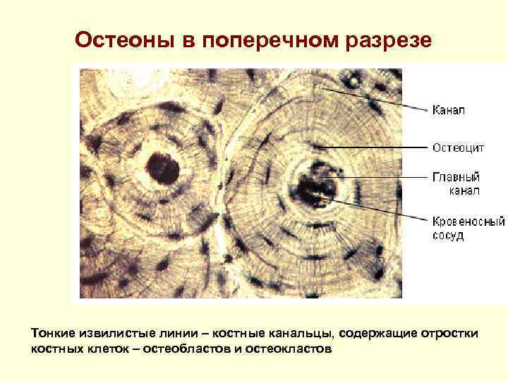 Остеоны в поперечном разрезе Тонкие извилистые линии – костные канальцы, содержащие отростки костных клеток