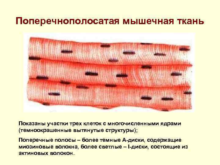 Поперечнополосатая мышечная ткань Показаны участки трех клеток с многочисленными ядрами (темноокрашенные вытянутые структуры); Поперечные