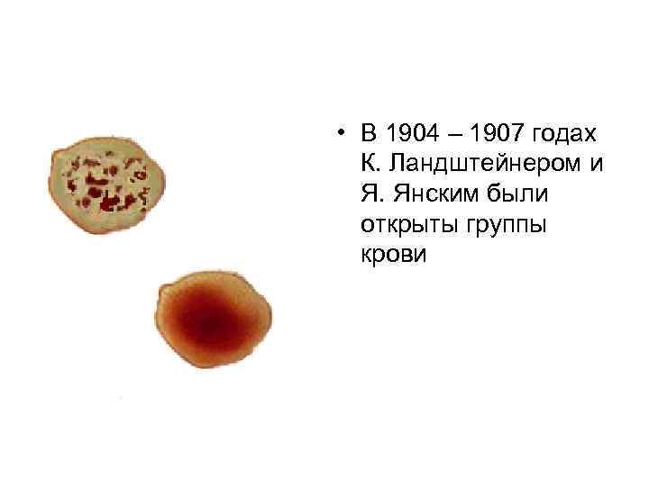  • В 1904 – 1907 годах К. Ландштейнером и Я. Янским были открыты