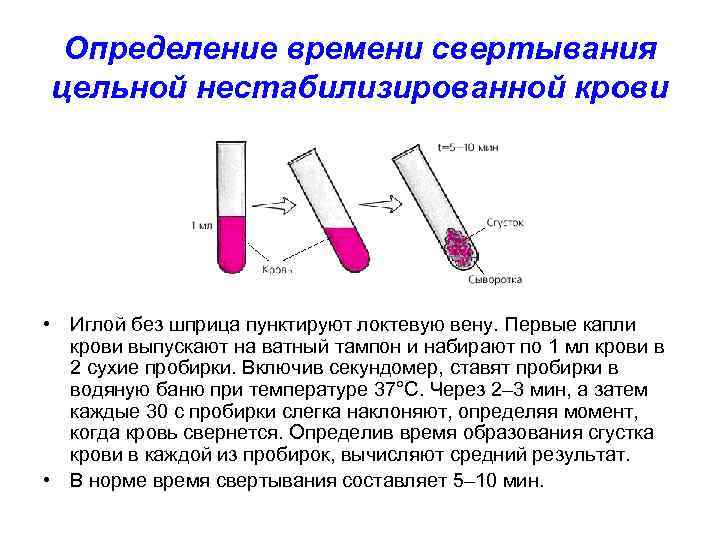Определение времени свертывания цельной нестабилизированной крови • Иглой без шприца пунктируют локтевую вену. Первые