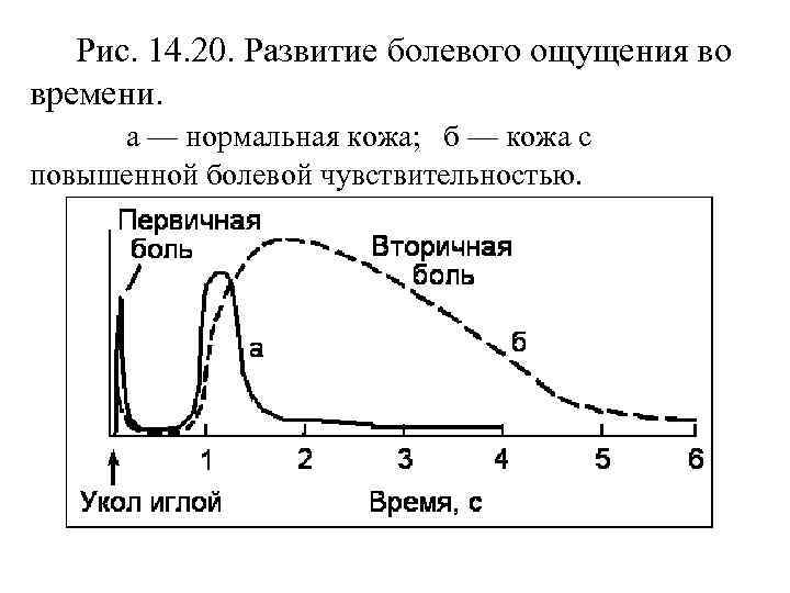 Рис. 14. 20. Развитие болевого ощущения во времени. а — нормальная кожа; б —