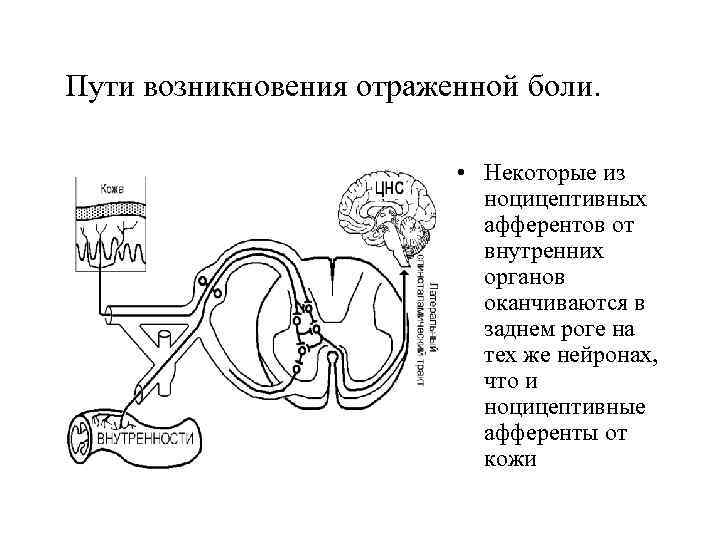 Пути возникновения отраженной боли. • Некоторые из ноцицептивных афферентов от внутренних органов оканчиваются в