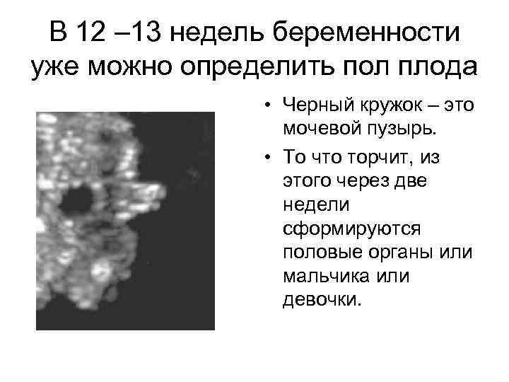 В 12 – 13 недель беременности уже можно определить пол плода • Черный кружок