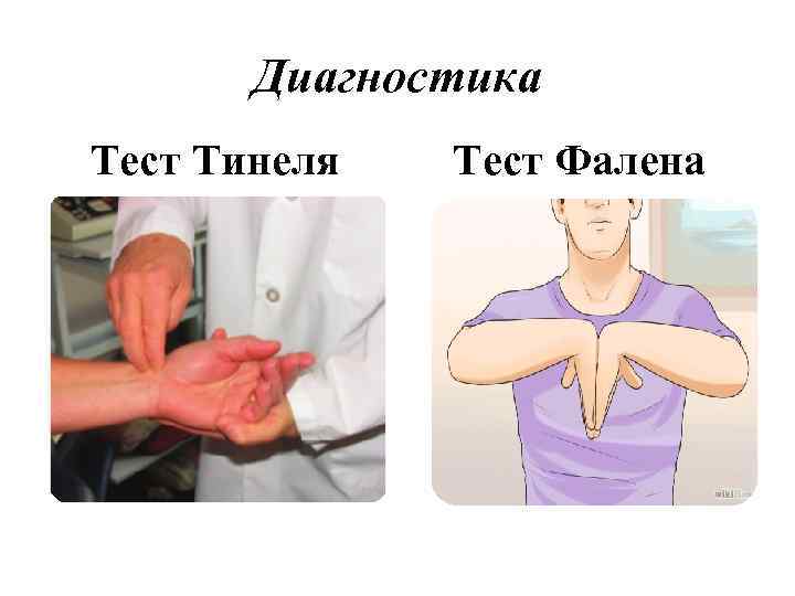 Диагностика Тест Тинеля Тест Фалена 