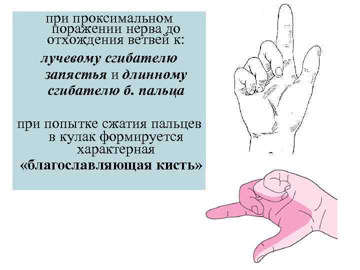 при проксимальном поражении нерва до отхождения ветвей к: лучевому сгибателю запястья и длинному сгибателю