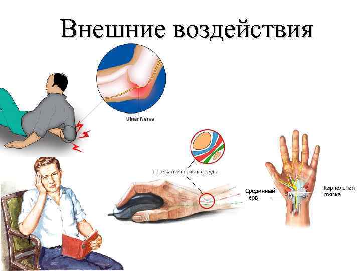 Внешние воздействия 