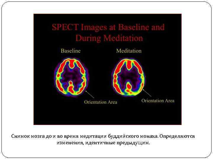 Снимок мозга до и во время медитации буддийского монаха. Определяются изменения, идентичные предыдущим. 