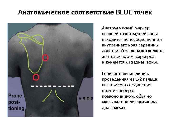 Анатомическое соответствие BLUE точек Анатомический маркер верхней точки задней зоны находится непосредственно у внутреннего