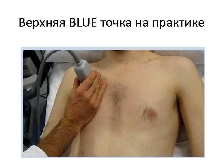 Верхняя BLUE точка на практике 