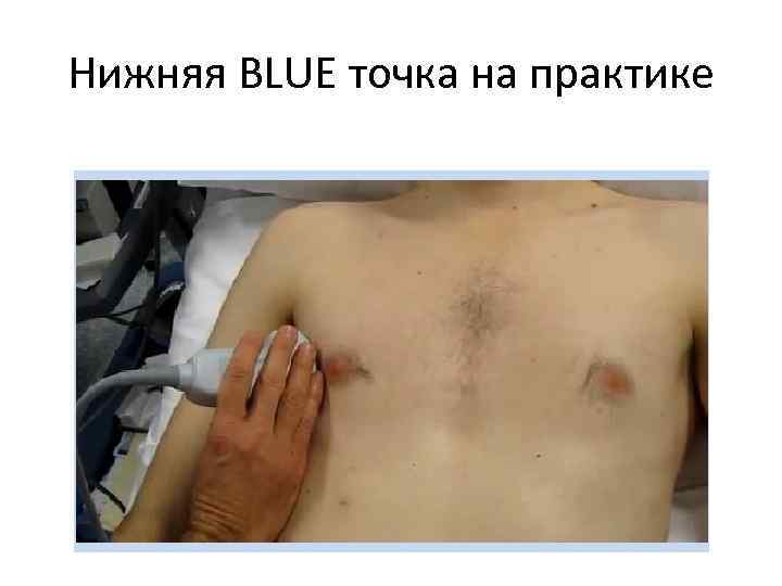 Нижняя BLUE точка на практике 