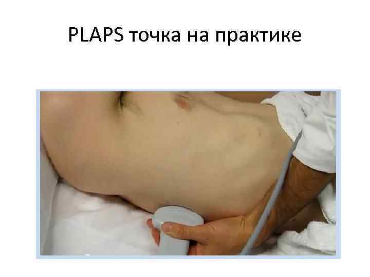 PLAPS точка на практике 