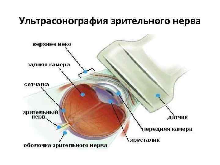 Ультрасонография зрительного нерва 