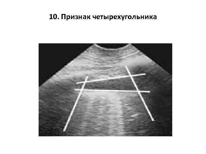 10. Признак четырехугольника 