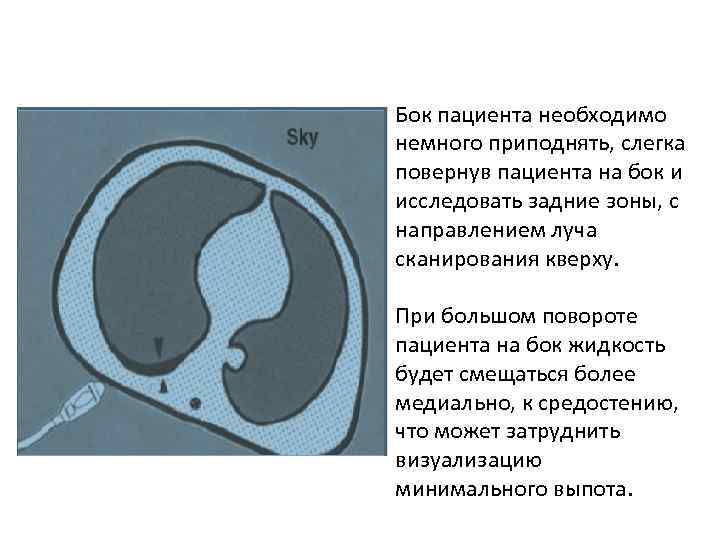 Бок пациента необходимо немного приподнять, слегка повернув пациента на бок и исследовать задние зоны,