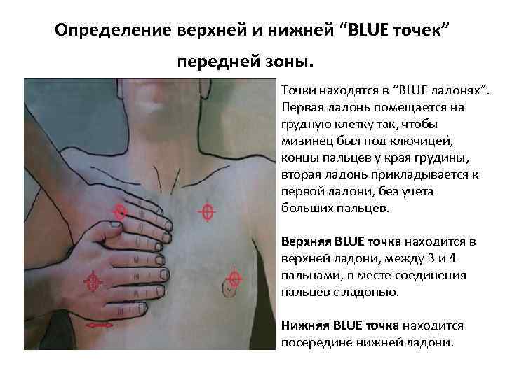 Определение верхней и нижней “BLUE точек” передней зоны. Точки находятся в “BLUE ладонях”. Первая