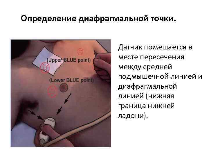 Определение диафрагмальной точки. Датчик помещается в месте пересечения между средней подмышечной линией и диафрагмальной