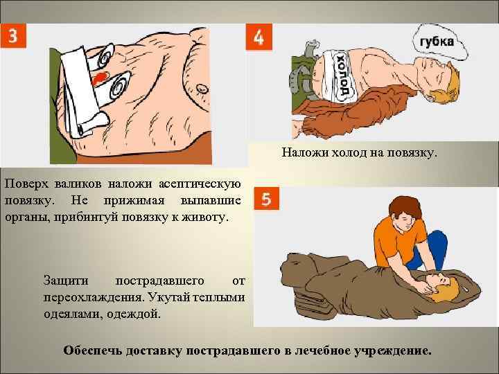 Наложи холод на повязку. Поверх валиков наложи асептическую повязку. Не прижимая выпавшие органы, прибинтуй