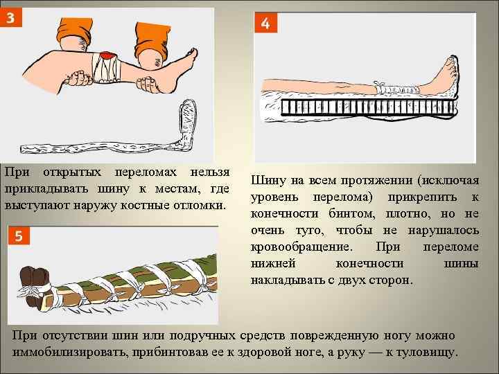 1 помощь при открытом переломе конечностей