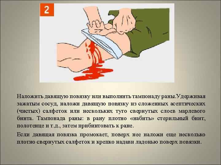 Наложить давящую повязку или выполнить тампонаду раны. Удерживая зажатым сосуд, наложи давящую повязку из
