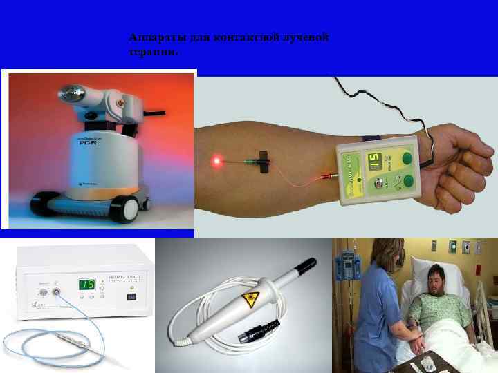 Аппараты для контактной лучевой терапии. 