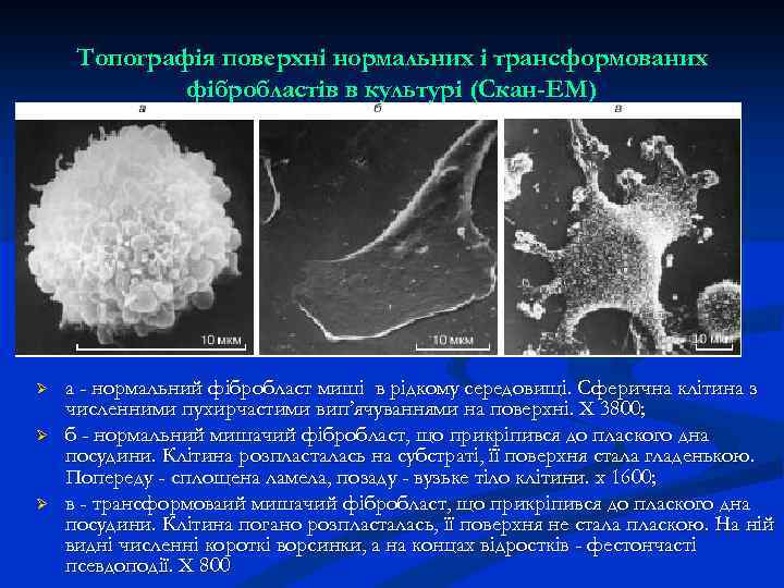 Топографія поверхні нормальних і трансформованих фібробластів в культурі (Скан-ЕМ) Ø Ø Ø а -