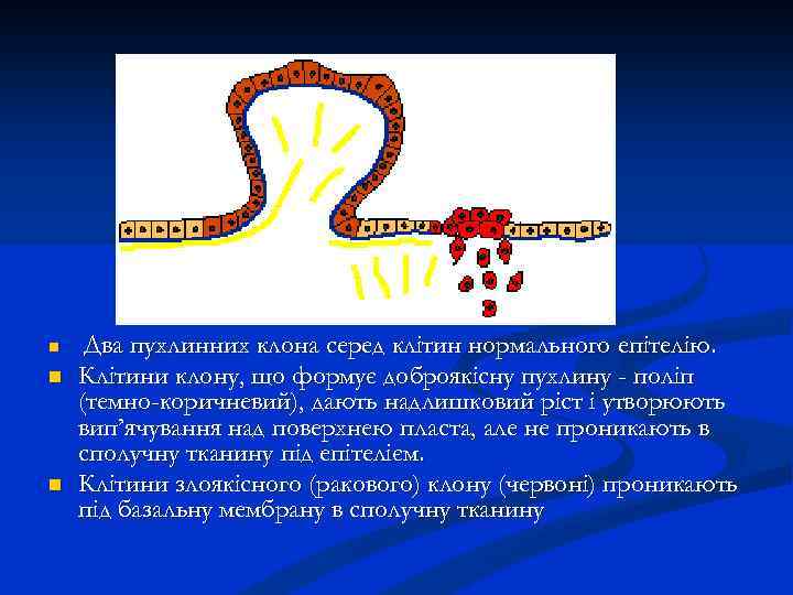 n n n Два пухлинних клона серед клітин нормального епітелію. Клітини клону, що формує