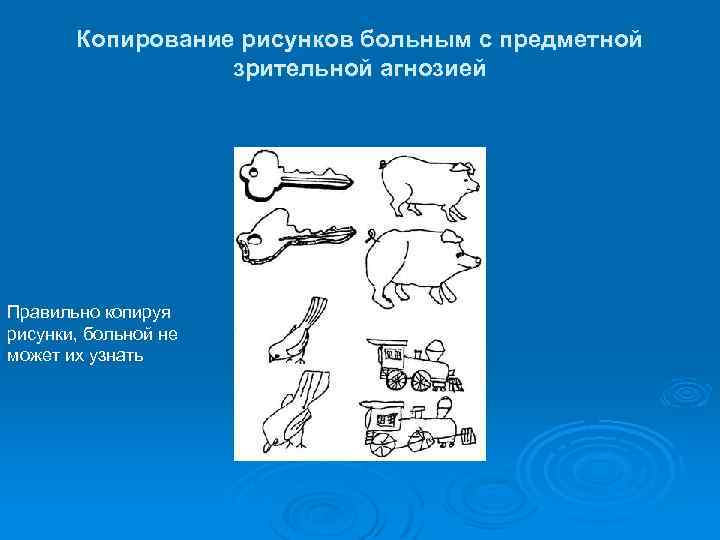 Копирование рисунков больным с предметной зрительной агнозией Правильно копируя рисунки, больной не может их