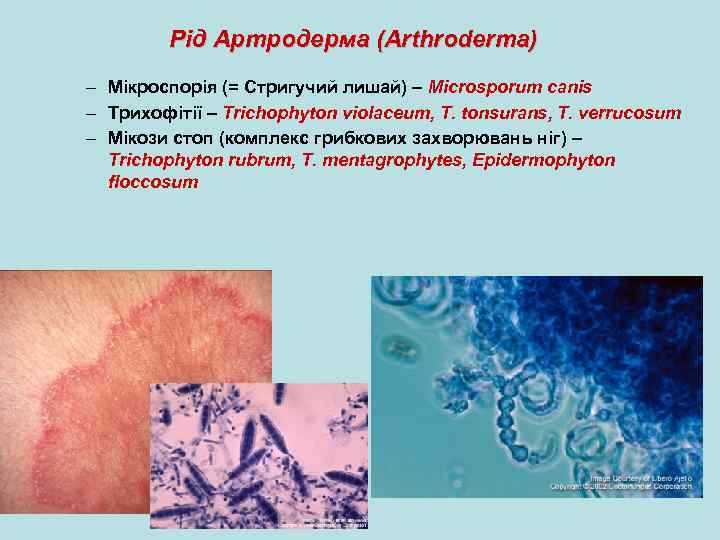 Рід Артродерма (Arthroderma) – Мікроспорія (= Стригучий лишай) – Microsporum canis – Трихофітії –