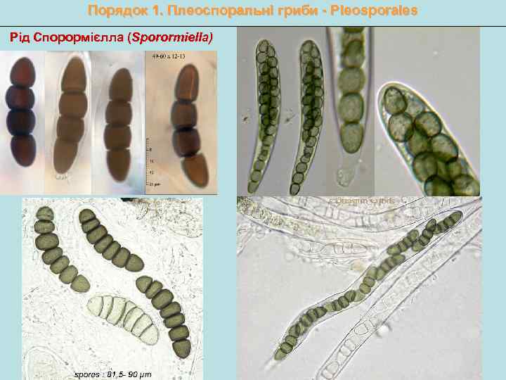 Порядок 1. Плеоспоральні гриби - Pleosporales Рід Спорормієлла (Sporormiella) 