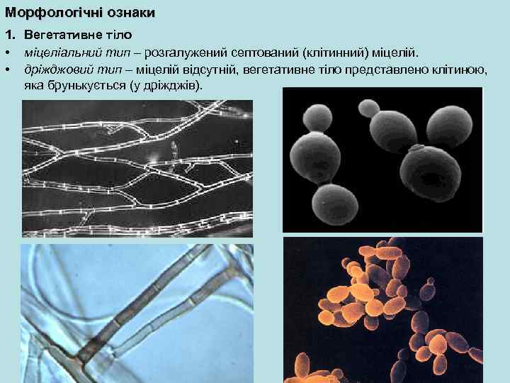 Морфологічні ознаки 1. Вегетативне тіло • міцеліальний тип – розгалужений септований (клітинний) міцелій. •