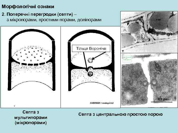 Морфологічні ознаки 2. Поперечні перегродки (септи) – з мікропорами, простими порами, доліпорами Тільця Вороніна