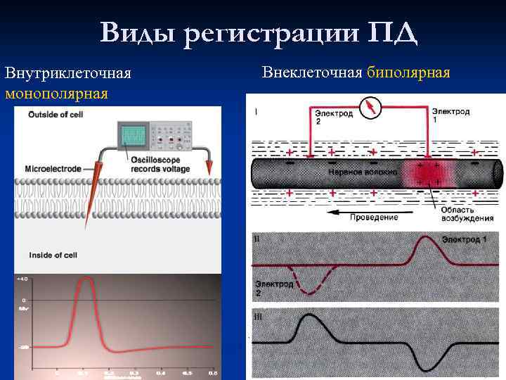 Виды регистрации ПД Внутриклеточная монополярная Внеклеточная биполярная 31 