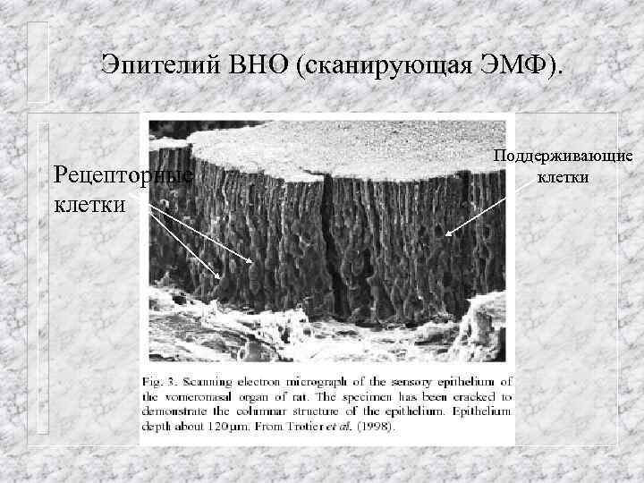 Эпителий ВНО (сканирующая ЭМФ). Рецепторные клетки Поддерживающие клетки 