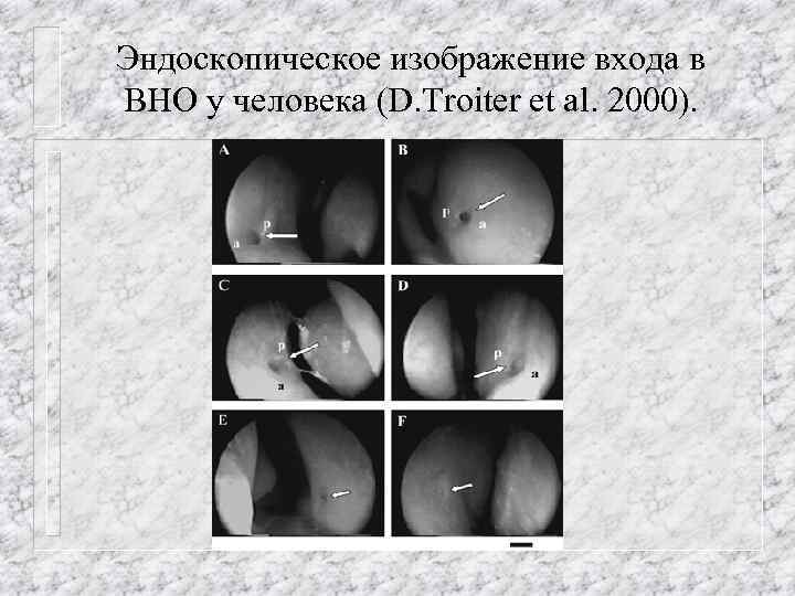 Эндоскопическое изображение входа в ВНО у человека (D. Troiter et al. 2000). 