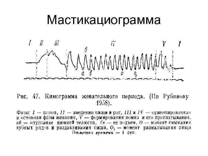 Мастикациограмма 