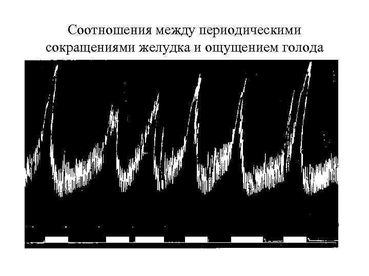 Соотношения между периодическими сокращениями желудка и ощущением голода 