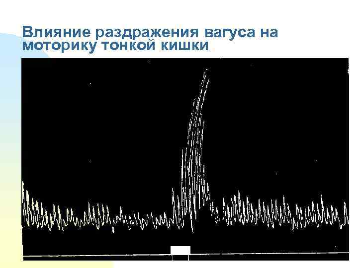 Влияние раздражения вагуса на моторику тонкой кишки 